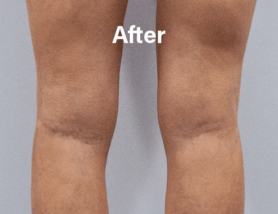 vipcenters_contents_before-after1
