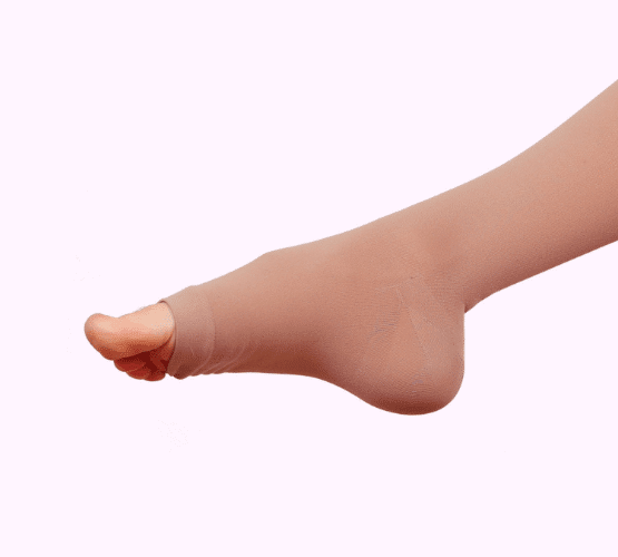 vipcenters_SpiderVeins_treatment_img3-min